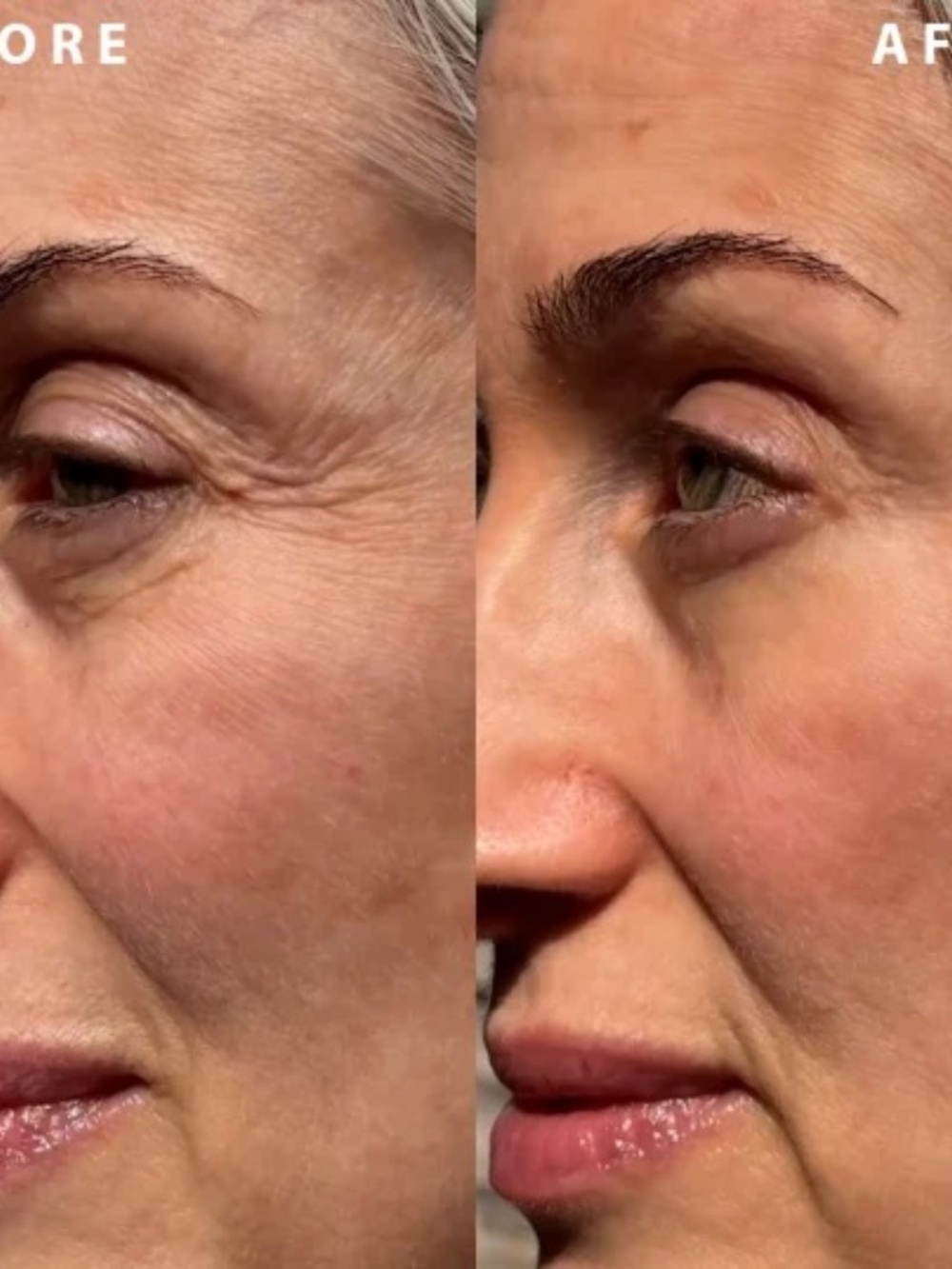 NIB IL MAKIAGE Wrinkle Filler - Picture 3 of 8